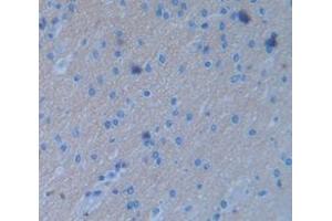 IHC-P analysis of Human Tissue, with DAB staining. (FGF3 antibody  (AA 154-232))