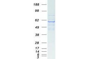 Validation with Western Blot (THRA Protein (Transcript Variant 2) (Myc-DYKDDDDK Tag))