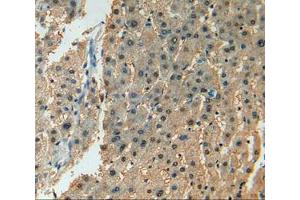 IHC-P analysis of liver tissue, with DAB staining. (ADCY7 antibody  (AA 806-1052))