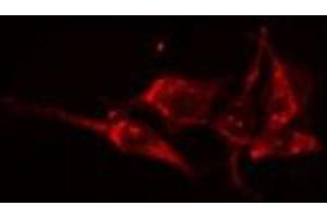 ABIN6275048 staining HuvEc cells by IF/ICC. (GBA3 antibody  (Internal Region))