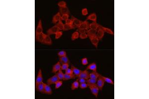 Immunofluorescence analysis of HeLa cells using SEC61 Rabbit pAb (1614) at dilution of 1:350 (40x lens).