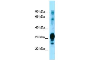 Western Blotting (WB) image for anti-Glycoprotein M6A (GPM6A) (C-Term) antibody (ABIN2790022) (GPM6A antibody  (C-Term))