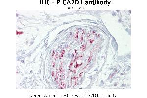 Image no. 1 for anti-Calcium Channel, Voltage-Dependent, alpha 2/delta Subunit 1 (CACNA2D1) (N-Term) antibody (ABIN347205)