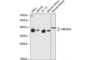 Western blot analysis of extracts of various cell lines using KIR2DL4 Polyclonal Antibody at dilution of 1:3000. (KIR2DL4/CD158d antibody)