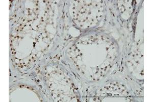 Image no. 1 for anti-Zinc Finger Protein 85 (ZNF85) (AA 2-77) antibody (ABIN466121) (ZNF85 antibody  (AA 2-77))