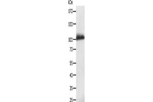 Gel: 8 % SDS-PAGE, Lysate: 40 μg, Lane: Human liver cancer tissue, Primary antibody: ABIN7130100(LRP12 Antibody) at dilution 1/200, Secondary antibody: Goat anti rabbit IgG at 1/8000 dilution, Exposure time: 10 minutes (LRP12 antibody)