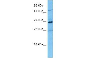 Host:  Mouse  Target Name:  KCNIP2  Sample Tissue:  Mouse Liver  Antibody Dilution:  1ug/ml (KCNIP2 antibody  (N-Term))