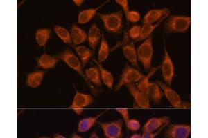 Immunofluorescence analysis of HeLa cells using UBQLNL Polyclonal Antibody at dilution of 1:100. (UBQLNL antibody)