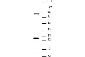 Suz12 antibody (pAb) tested by Western blot. (SUZ12 antibody  (C-Term))