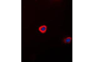 Immunofluorescent analysis of Connexin 43 staining in HeLa cells. (Connexin 43/GJA1 antibody  (C-Term))