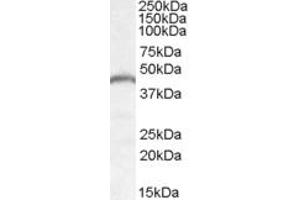 Western Blotting (WB) image for anti-Patatin-Like phospholipase Domain Containing 3 (PNPLA3) (Internal Region) antibody (ABIN2466551)