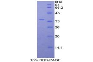 SDS-PAGE (SDS) image for Myosin IF (MYO1F) (AA 491-767) protein (His tag) (ABIN1877671) (MYO1F Protein (AA 491-767) (His tag))