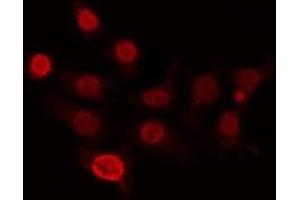 Immunofluorescence (fixed cells) (IF/ICC) image for anti-Cyclin-Dependent Kinase-Like 4 (CDKL4) (Internal Region) antibody (ABIN6260726)