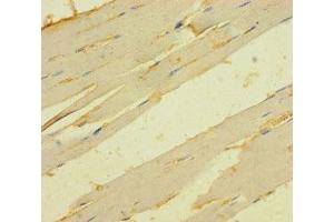Immunohistochemistry of paraffin-embedded human skeletal muscle tissue using ABIN7173277 at dilution of 1:100 (TMEM82 antibody  (AA 168-202))
