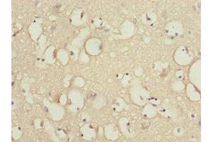 Immunohistochemistry of paraffin-embedded human brain tissue using ABIN7157257 at dilution of 1:100
