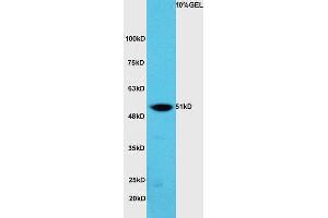 Lane 1:A549 cell lysates probed with Rabbit Anti-hnRNP K Polyclonal Antibody, Unconjugated (ABIN706571) at 1:300 overnight at 4 °C.