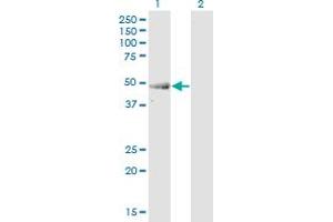 Western Blot analysis of ENO3 expression in transfected 293T cell line by ENO3 monoclonal antibody (M04), clone 3C6. (ENO3 antibody  (AA 1-434))