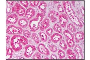 Human Kidney: Formalin-Fixed, Paraffin-Embedded (FFPE) (TNK2 antibody  (AA 278-289))
