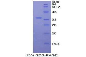 SDS-PAGE (SDS) image for V-Akt Murine Thymoma Viral Oncogene Homolog 2 (AKT2) (AA 142-412) protein (His tag) (ABIN1877971) (AKT2 Protein (AA 142-412) (His tag))