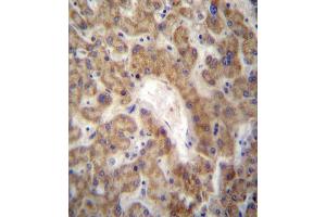CXCL12 Antibody (C-term) (ABIN657319 and ABIN2846394) immunohistochemistry analysis in formalin fixed and paraffin embedded human liver tissue followed by peroxidase conjugation of the secondary antibody and DAB staining.