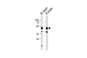 Western blot analysis of lysates from mouse heart, rat brain tissue (from left to right), using CHRNB3 Antibody (Center) (ABIN6244215 and ABIN6577603). (CHRNB3 antibody  (AA 187-200))