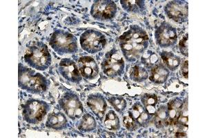 IHC analysis of ME2 using anti-ME2 antibody (ABIN7600967). (NAD-ME antibody  (AA 26-584))