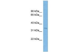 SSR1 antibody used at 1 ug/ml to detect target protein. (SSR1 antibody  (Middle Region))