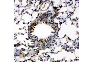 Anti-Caspase-6(P18) antibody, IHC(P): Mouse Lung Tissue (Caspase 6 antibody  (N-Term))