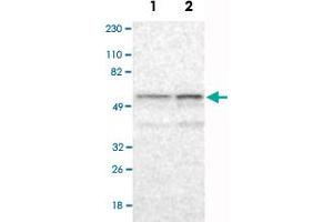 Western Blot analysis of Lane 1: RT-4 and Lane 2: U-251MG sp cell lysates with RBM23 polyclonal antibody .