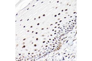 Immunohistochemistry of paraffin-embedded human normal cervix using CTCF Rabbit pAb (ABIN6130043, ABIN6139180, ABIN6139182 and ABIN6217207) at dilution of 1:100 (40x lens). (CTCF antibody  (AA 1-260))