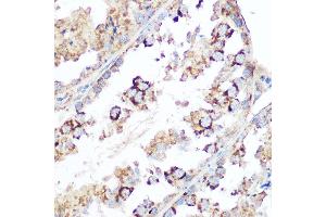 Immunohistochemistry of paraffin-embedded mouse testis using Smac/Diablo Rabbit pAb (ABIN3023378, ABIN3023379, ABIN3023380 and ABIN6219667) at dilution of 1:100 (40x lens). (DIABLO antibody  (AA 1-232))
