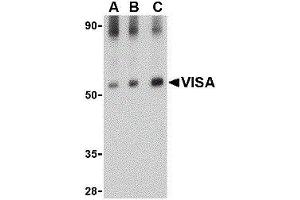 Western Blotting (WB) image for anti-Mitochondrial Antiviral Signaling Protein (MAVS) antibody (ABIN2477103) (MAVS antibody)