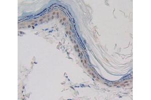 Used in DAB staining on fromalin fixed paraffin- embedded skin tissue (CASP14 antibody  (AA 1-246))