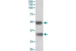 GEM polyclonal antibody  (1 ug/mL) staining of human spleen lysate (35 ug protein in RIPA buffer). (GEM antibody  (AA 34-46))