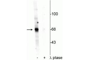 Western blot of Drosophila lysate showing specific labeling of the ~68 kDa AKT protein phosphorylated at Thr342 in the first lane (-). (AKT1 antibody  (pThr342))