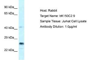 Host: Rabbit Target Name: bK150C2. (bK150C2.9 (C-Term) antibody)