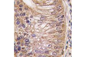 Image no. 1 for anti-Prostate Stem Cell Antigen (PSCA) (Middle Region) antibody (ABIN356897) (PSCA antibody  (Middle Region))