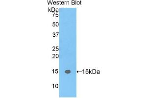 Western blot analysis of the recombinant protein. (FABP5 antibody  (AA 2-135))