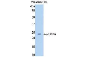 Detection of Recombinant SIRT4, Rat using Polyclonal Antibody to Sirtuin 4 (SIRT4) (SIRT4 antibody  (AA 60-255))
