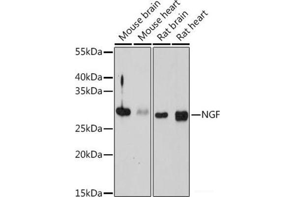 Nerve Growth Factor antibody