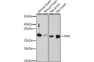 Western blot analysis of extracts of various cell lines using NGF Polyclonal Antibody at dilution of 1:1000. (Nerve Growth Factor antibody)