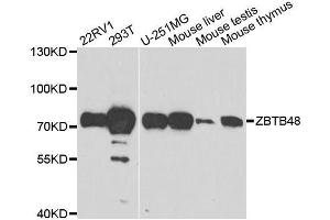 Western blot analysis of extracts of various cell lines, using ZBTB48 antibody. (ZBTB48 antibody  (AA 1-280))