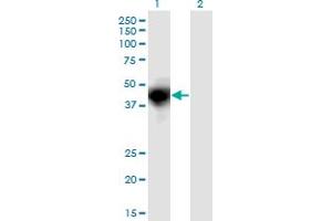 Western Blot analysis of OSMR expression in transfected 293T cell line by OSMR monoclonal antibody (M03), clone 3E12.