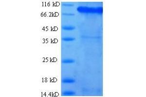 Integrin beta 1 (ITGB1) (AA 21-729) protein (His tag) expressed in E. (ITGB1 Protein (AA 21-729) (His tag))