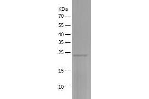 Western Blotting (WB) image for Zinc Finger, C4H2 Domain Containing (ZC4H2) (AA 1-224) protein (His tag) (ABIN7125807) (ZC4H2 Protein (AA 1-224) (His tag))