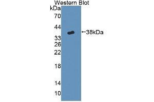Detection of Recombinant CYP17A1, Mouse using Polyclonal Antibody to Cytochrome P450 17A1 (CYP17A1) (CYP17A1 antibody  (AA 201-507))