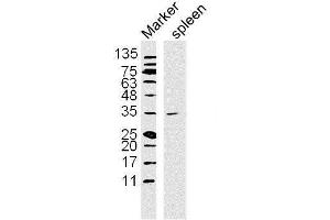 Lane 1: Mouse Spleen lysates probed with NFKBIA/IKB alpha Polyclonal Antibody, Unconjugated  at 1:300 overnight at 4˚C. (NFKBIA antibody  (AA 1-120))