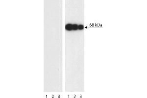 Western blot analysis of PLK1 (pT210) in transformed human epithelioid carcinoma. (PLK1 antibody  (pThr210))