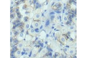IHC-P analysis of Rat Tissue, with DAB staining. (LCT antibody  (AA 33-291))