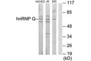 Western blot analysis of extracts from Jurkat/HuvEc/293 cells, using hnRNP Q Antibody.